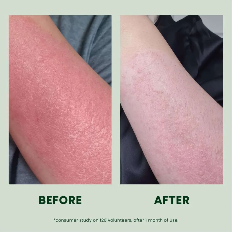 Nurture Lotion 50 ML | Vulnerable/Dry Skin Lotion - Image 3